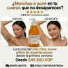 Jabón Antimanchas y Antiacné 🤩 Dermabella®
